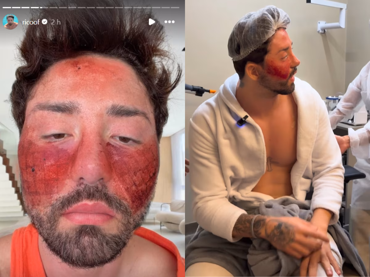 Rico Melquiades confessa vício e transforma desabafo em alerta: 