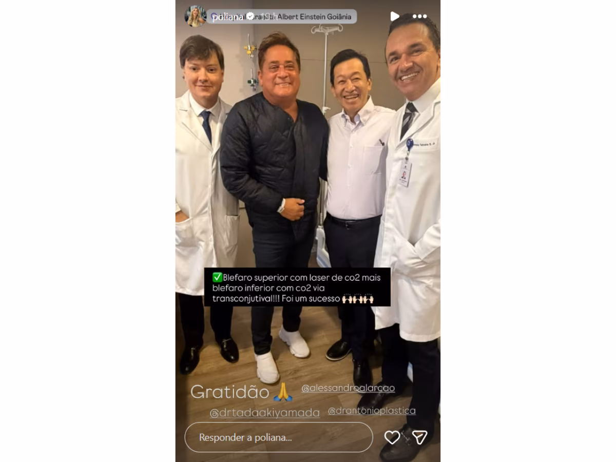 Antes e depois de Leonardo retirar excesso de pele e gordura das pálpebras