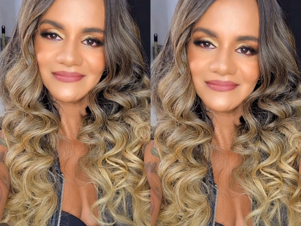 Mulher agredida com 61 socos pelo namorado mostra resultado de reconstrução facial