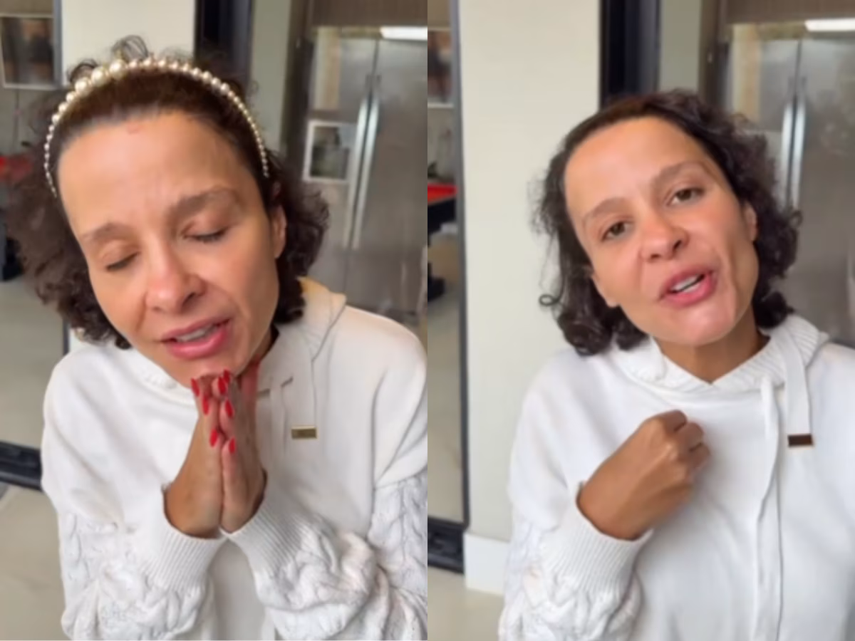 A artista, que recebeu o diagnóstico de alopecia androgenética, uma queda de cabelo do couro cabeludo progressiva