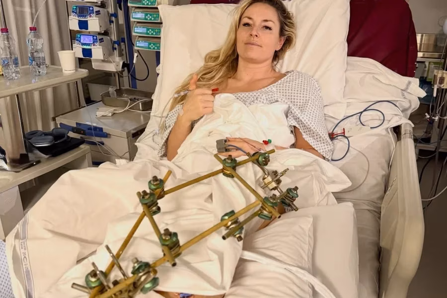 A esquiadora Lindsey Vonn sofreu um acidente grave no último domingo (8/2) durante uma prova de esqui nas Olimpíadas de Inverno
