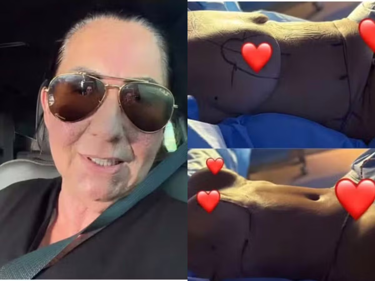 Margareth Serrão tem alta após cirurgias plásticas e comemora resultado: 