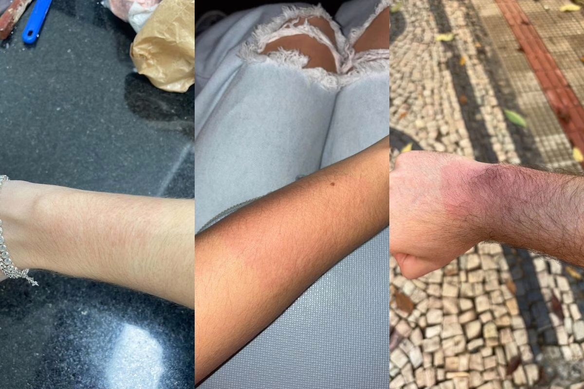 Fãs denunciam queimaduras e alergias após uso de pulseiras de iluminação no show do Luan Santana, em BH