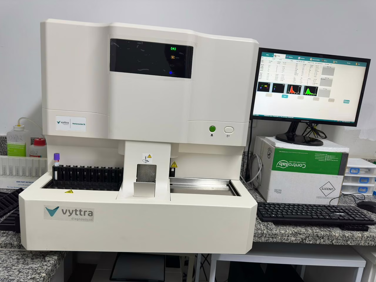 03.03 - Release PMT - Laboratório da Prefeitura de Timóteo amplia capacidade e se moderniza para atender mais pessoas