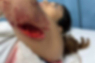 Mesmo ferida, a tutora saiu à procura do animal em meio ao trânsito e conseguiu encontrá-lo pouco depois.