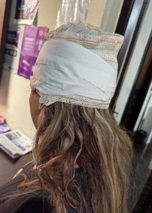 Segundo a Guarda Civil Municipal, a vítima foi socorrida, bem assustada, e com grave ferimento na cabeça.