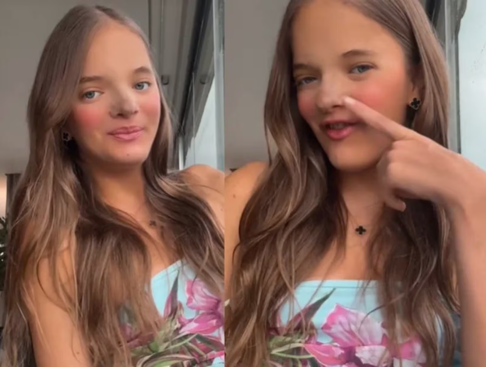 Filha de Roberto Justus e Ticiane Pinheiro revela novo procedimento.