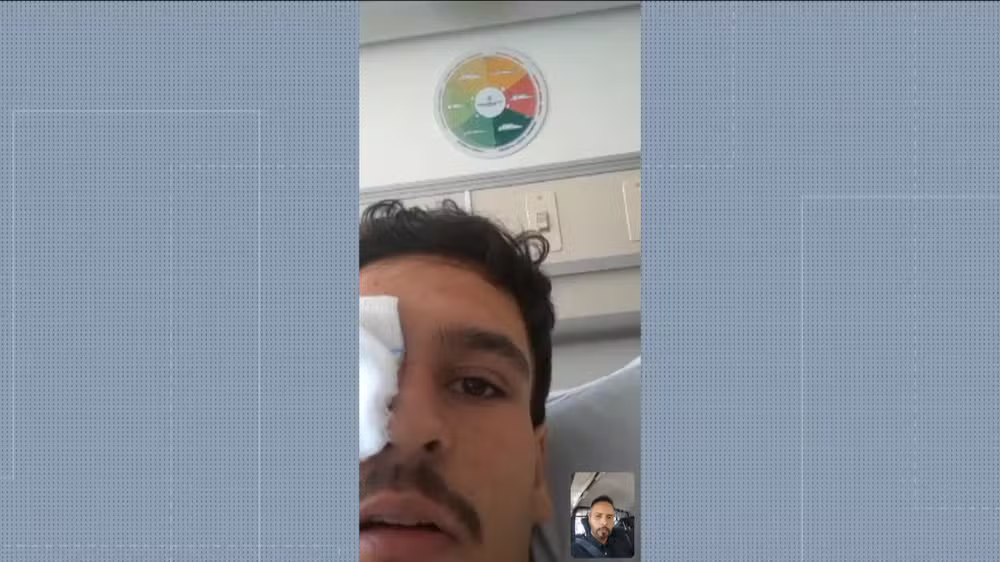 Arthur Cortines foi alvo de um tiro por bala de borracha no olho