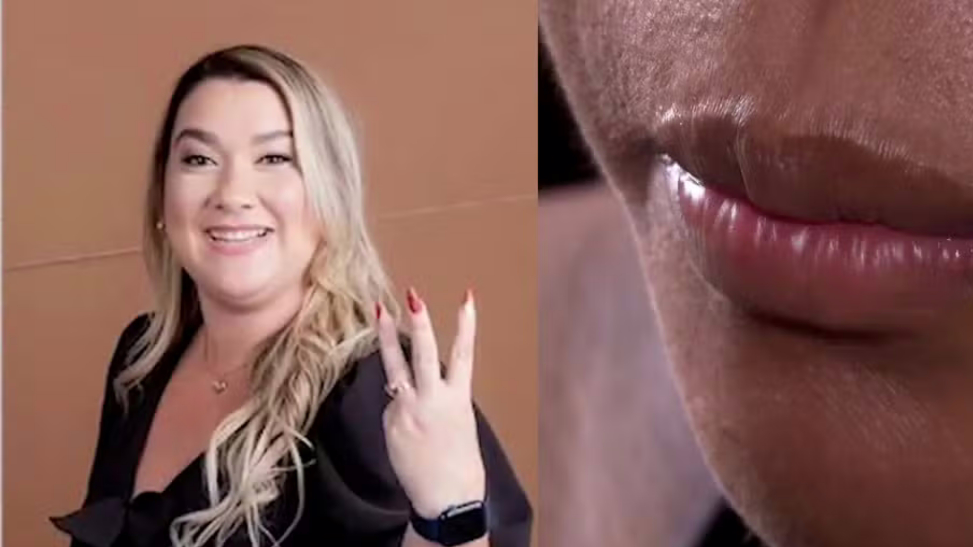 A empresária Carolina Sthela é suspeita de agredir a ex-funcionária de 19 anos na Grande São Luís