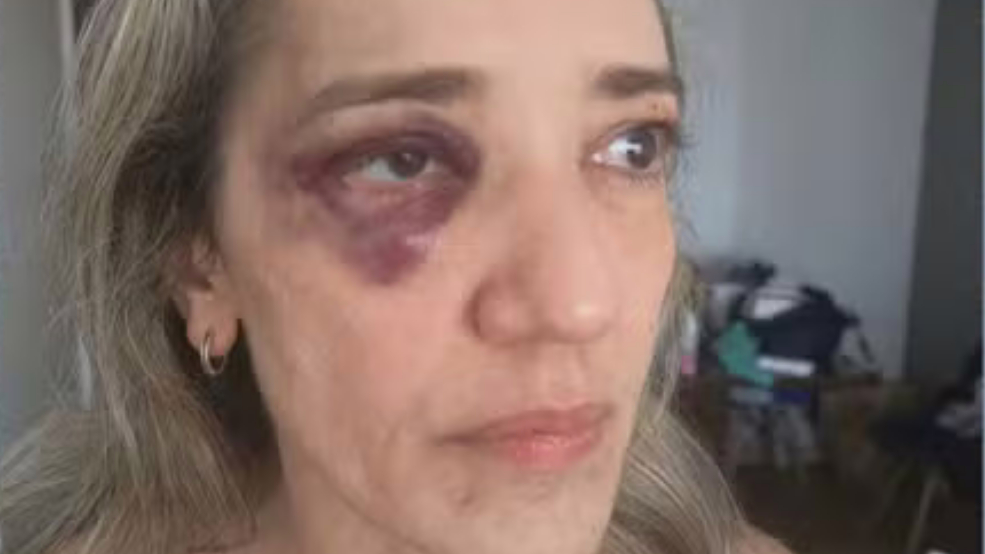 Ana Cristina Durão Nunes denuncia ter sido agredida por motorista de aplicativo na Zona Sul do Rio