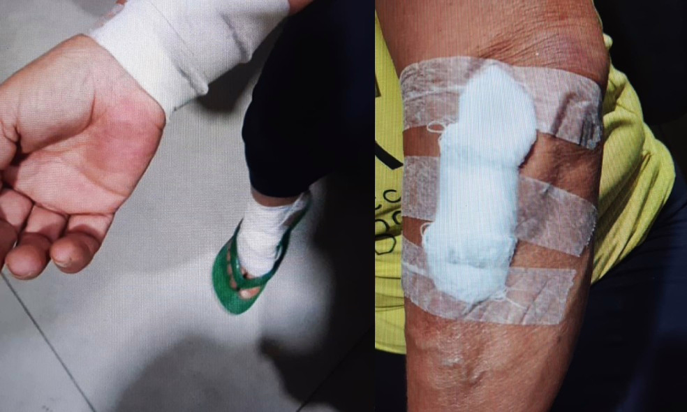 Homem é detido após agredir a irmã em discussão por bananeira em Piraí