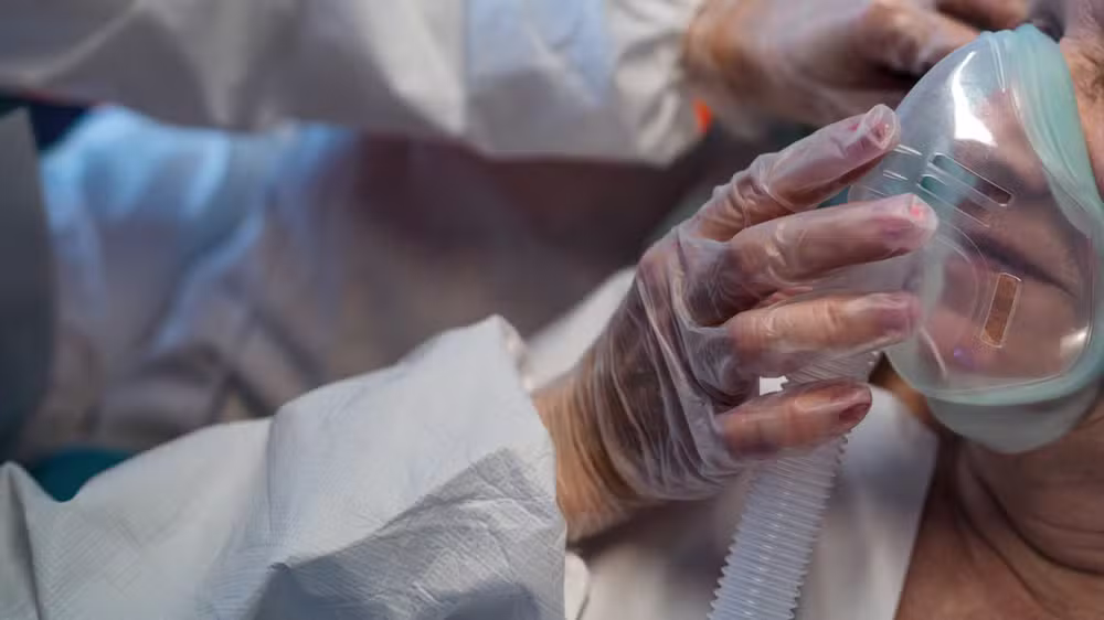 Os principais vírus da síndrome são a Influenza A (H1N1 e H3N2) e o vírus sincicial respiratório (VSR)