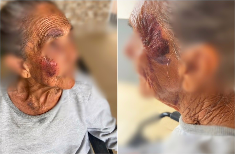 Idosa de 96 anos é resgatada sob suspeita de maus-tratos em Salto de Pirapora