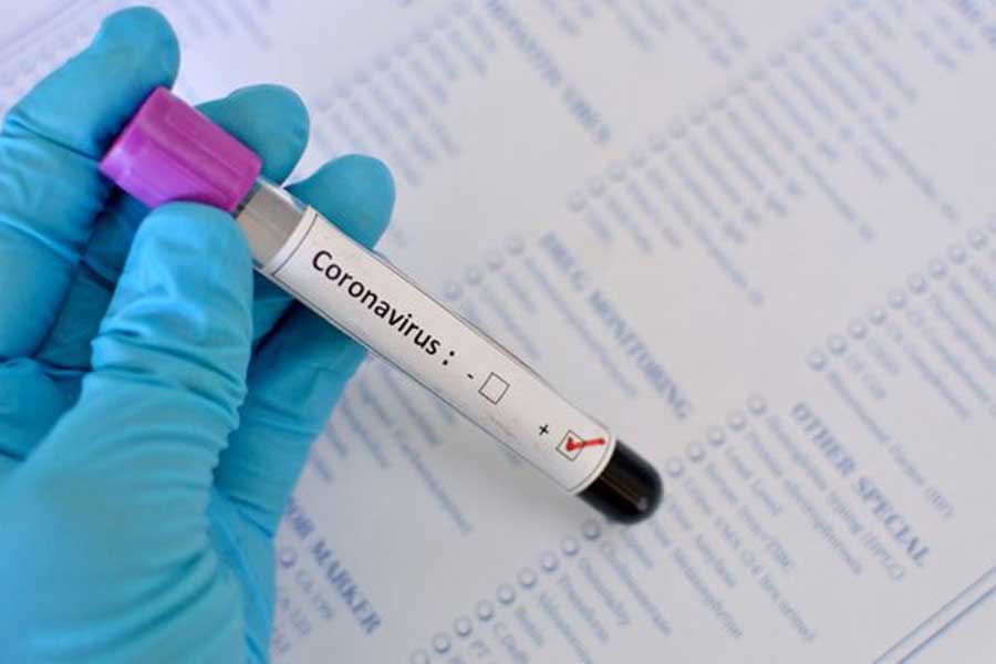 coronavirus-2