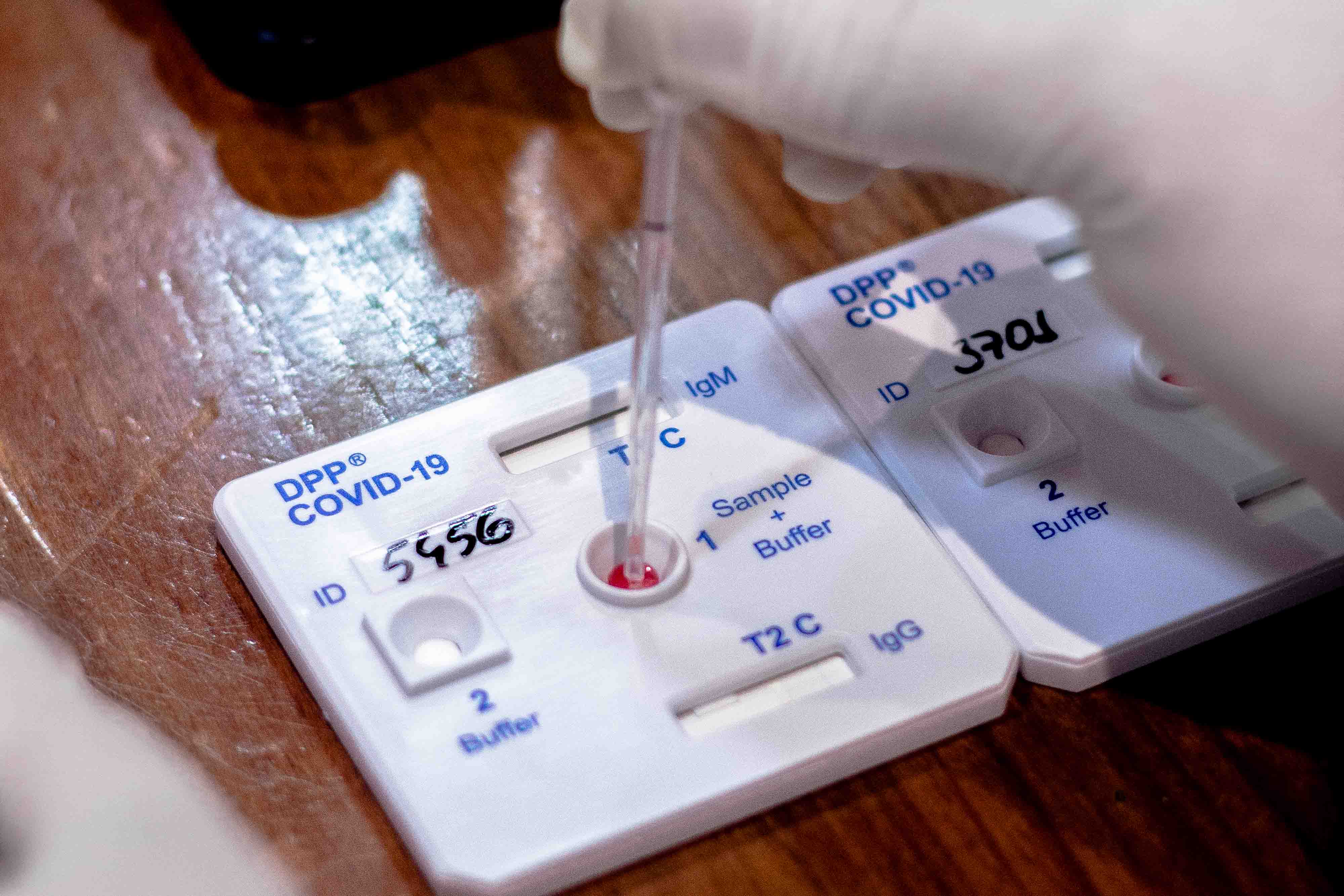 medicamento pode ser capaz de reduzir chance de forma grave de covid