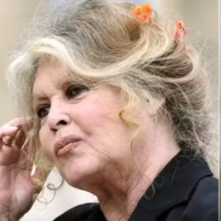 Brigitte Bardot é hospitalizada às pressas na França por doença grave
