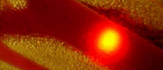 laser_cancer.jpg