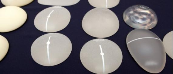 protese-de-silicone1-620x413.jpg