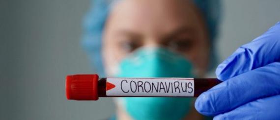 coronavirus_10.jpg