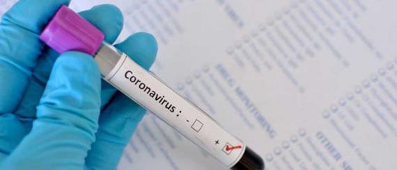 coronavirus-2.jpg