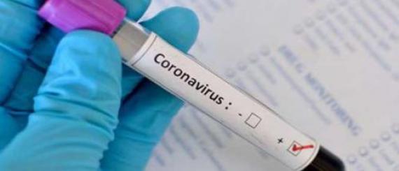 coronavirus-2.jpg