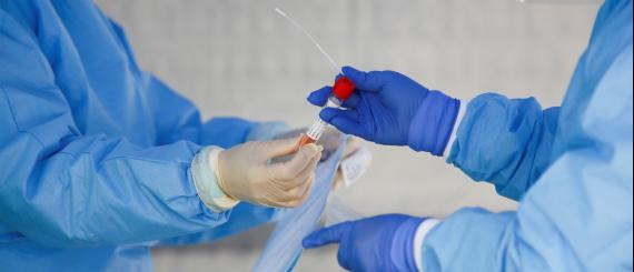 teste-coronavirus.jpg