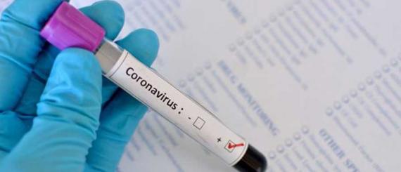 coronavirus-2.jpg