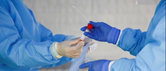teste-coronavirus.jpg
