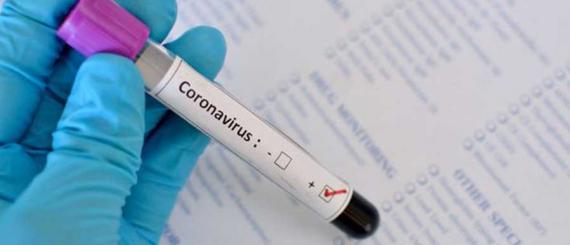 coronavirus-2.jpg