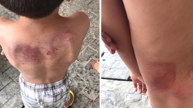 Criança agredida