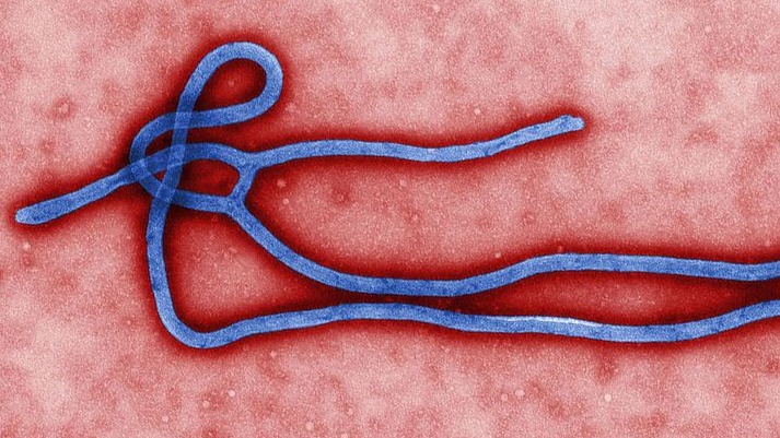 ebola