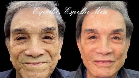 dedé