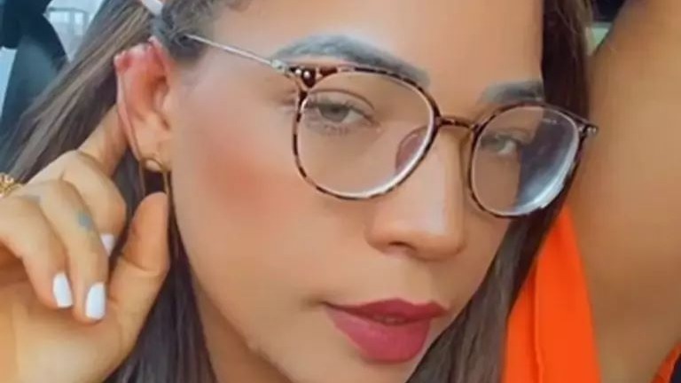 Parte da orelha da vendedora foi arrancada (Foto: Reprodução / Instagram)