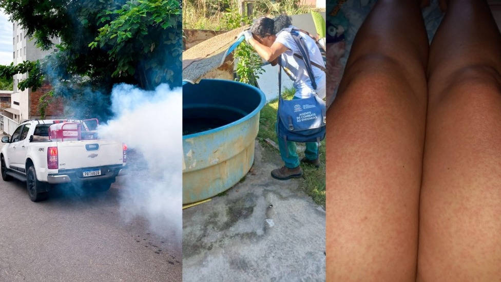 dengue