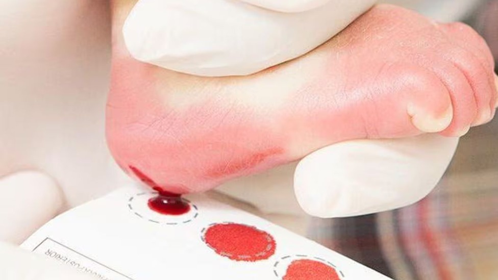Foto: Ascom PMI / Divulgação
