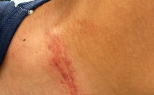 Aluno especial de 13 anos sofre agressão de professor em escola de MG