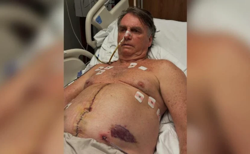 Bolsonaro agradece apoio e atualiza recuperação na Páscoa