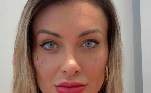Andressa Urach enfrenta complicações após cirurgia para mudar cor dos olhos