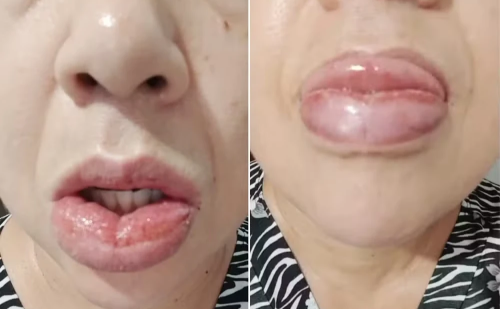 Colgate retira de linha versão Clean Mint após centenas de queixas à Anvisa