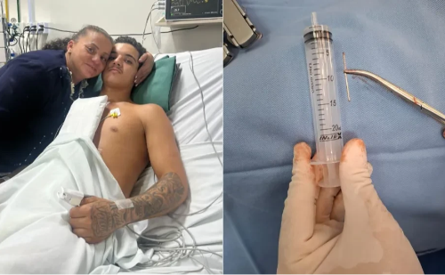 Adolescente sobrevive após prego atingir o coração em acidente com ferramenta
