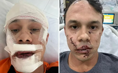 Confissão no DF revela agressor que atacou personal com taça em bar de SP