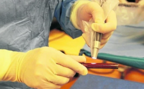 Nova prótese 3D com antibiótico mostra eficácia contra infecções pós-cirúrgicas