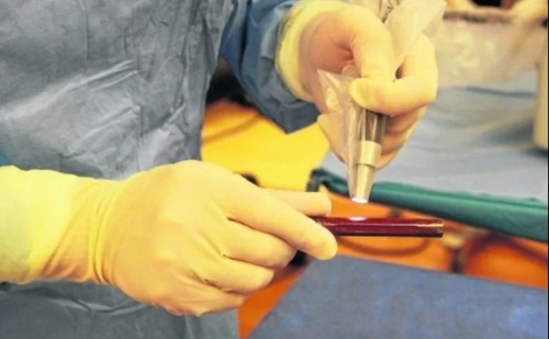 Nova prótese 3D com antibiótico mostra eficácia contra infecções pós-cirúrgicas