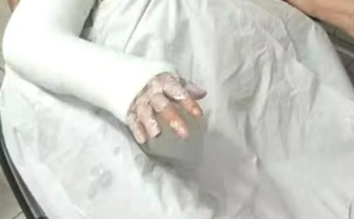 Mulher é presa após espancar idosa com cabo de vassoura no RJ