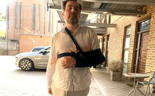 Homem que diz ter o maior pênis do mundo sofre acidente após não enxergar os pés por causa do volume do órgão genital