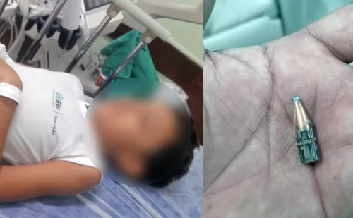 Criança é atingida por bala perdida enquanto participava de atividade física em escola no Rio