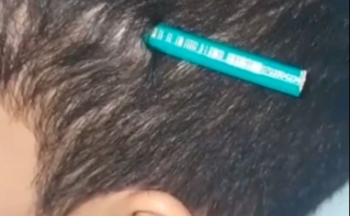 Aluno crava lápis na cabeça de colega durante briga em escola no litoral de SP