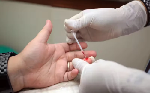 HIV cria refúgio no intestino e desafia ação de remédios, aponta pesquisa