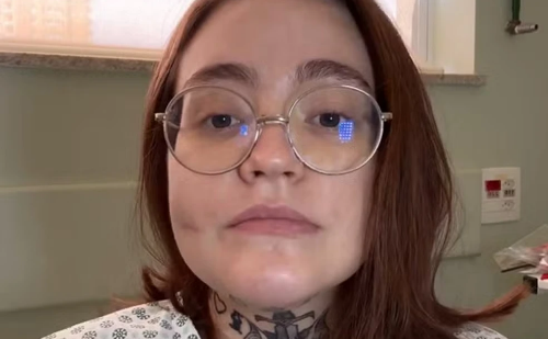 Coma induzido não alivia 'pior dor do mundo' em jovem com neuralgia do trigêmeo em MG