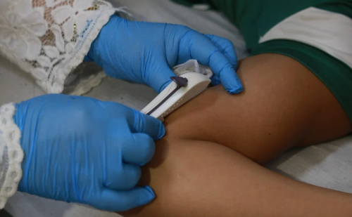 Fortaleza inicia distribuição de anticoncepcional para adolescentes a partir dos 10 anos